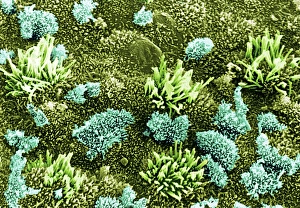 Coloured SEM of uterus wall (early proliferation) Coloured SEM of uterus wall (early proliferation)
