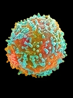 Coloured SEM of a white blood cell (lymphocyte) Coloured SEM of a white blood cell (lymphocyte)