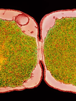 Coloured TEM of E. coli bacteria dividing Coloured TEM of E. coli bacteria dividing