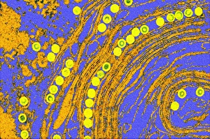 Coloured TEM of herpes simplex viruses inside cell Coloured TEM of herpes simplex viruses inside cell