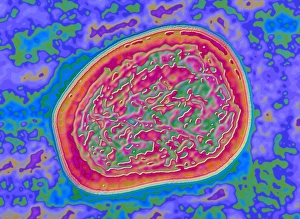 Coloured TEM of mumps virus, Rabula inflans Coloured TEM of mumps virus, Rabula inflans