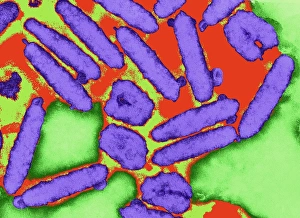 Coloured TEM of nuclear polyhedrosis viruses Coloured TEM of nuclear polyhedrosis viruses