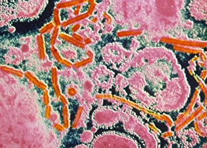 Coloured TEM of parainfluenza virus particles Coloured TEM of parainfluenza virus particles