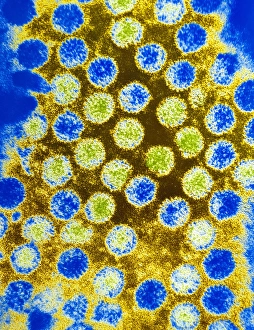 Coloured TEM of rotaviruses Coloured TEM of rotaviruses