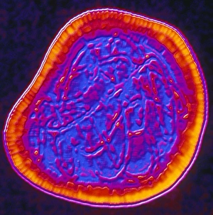 Coloured TEM of a rubella (German measles) virus Coloured TEM of a rubella (German measles) virus