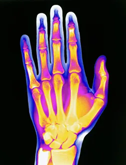 Coloured X-ray of the healthy hand of a man Coloured X-ray of the healthy hand of a man
