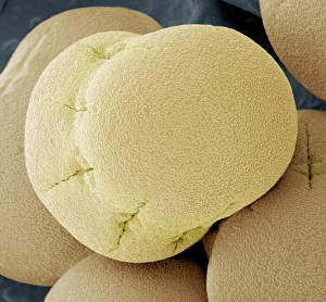 SEM Images Of Pollen Prints: Comfrey pollen, SEM