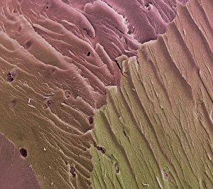 Knee Joint Anatomy Prints: Compact bone, SEM