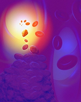 Computer artwork of a blood clot Computer artwork of a blood clot