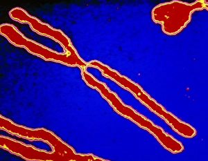 Computer-enhanced LM of human chromosomes Computer-enhanced LM of human chromosomes