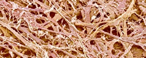 Scanning Electron Micrograph SEM Images Prints: Connective tissue, SEM C015 / 9926