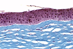 Cornea Cornea