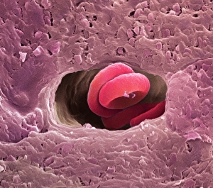 Human Body Circulatory System Prints: Coronary capillary, SEM