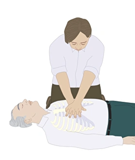 CPR First Aid Technique Print: Chest Compressions