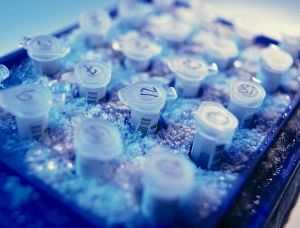 Cryostorage of DNA samples in microtubes Cryostorage of DNA samples in microtubes