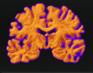 Cerebrum Structure Prints: CT scan of brain