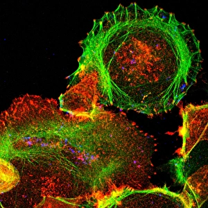 Light Micrograph Images Prints: Cultured cell, light micrograph