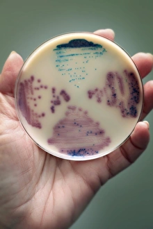 E Coli Bacteria Prints: Cultured E. coli and Enterococcus bacteria