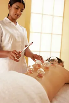 Prints of MODEL RELEASED. Cupping. Therapist heating cups on a clients back Images Dated 2006 April: Cupping Print: Heated Cups on Client's Back
