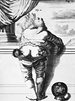 Alternative Healing Methods Prints: Cupping, historical artwork