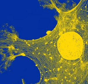 Prints of Cytoskeleton. Coloured transmission electron micrograph (TEM) of the cytoskeleton of a human skin cell. The cell nucleus is at centre right Images Dated 2011 July: TEM Cytoskeleton Print: Human Skin Cell Microstructure
