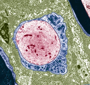 Coloured TEM Images Prints: Demyelinated nerve, TEM