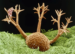 Protozoan Micrograph Prints: Dendrocometes protozoan