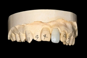 Images Dated 8th March 2013: Human Mouth Dental Model Print