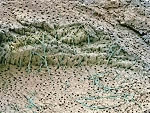 Scanning Electron Microscope Images Prints: Dentin tooth tissue, SEM