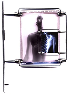 Prints of Diagnostic imaging. Conceptual computer artwork of a human figure with an exposed X-ray plate over his arm and ribcage. This may represent diagnostic medical imaging Images Dated 2004 January: Diagnostic Imaging Print: Exposed X-ray Plate
