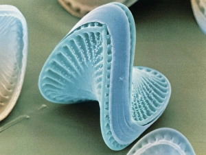 Diatom algae, Campylodiscus Diatom algae, Campylodiscus