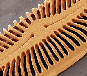 Print of Diatom Frustule, SEM