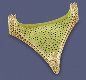 SEM Print of Triceratium sp. Diatom Cell Wall Structure