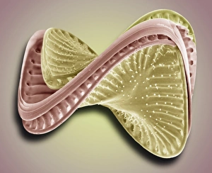 SEM Print of a Campylodiscus costatus Diatom
