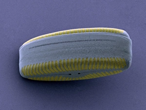SEM Diatom Print, 10 cm wide