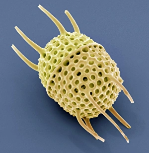 SEM Diatom Print, Stephanopyxis sp