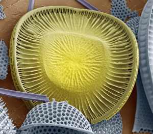 Prints of Diatom. Coloured scanning electron micrograph (SEM) of a Campylodiscus sp. diatom (yellow), surrounded by other types of diatoms (blue) Images Dated 2009 May: SEM Diatom Print, 10cm wide