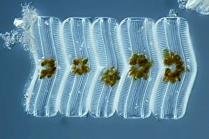 Light Micrograph Prints: Diatoms, light micrograph C014 / 4671