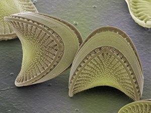 SEM Diatom Print, 6x7cm
