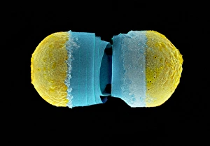 Coloured SEM Print of Diatom Cell Walls