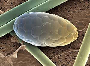 SEM Print of Dinoflagellate Chilostomella sp