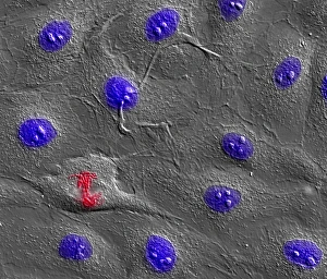 Cell Division Micrograph Prints: Dividing cell