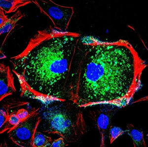 Light Micrograph Images Prints: Dividing cell, light micrograph