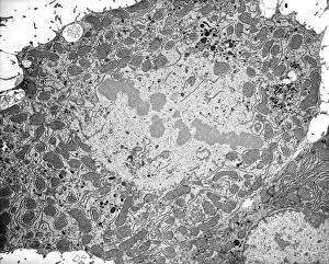 Transmission Electron Micrograph Prints: Dividing cell, TEM