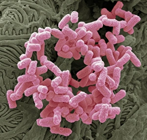 SEM Print of E. coli Bacteria on Human Kidney Tissue at x6000 Magnification