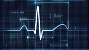 Medical Diagnostic Tool Prints: ECG trace C017 / 7743