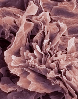 Prints of Eczema, coloured scanning electron micrograph (SEM). Eczema is a form of dermatitis or inflammation of the upper layers of the skin Images Dated 2008 August: Eczema Print, SEM x800