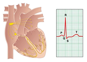 Prints of Electrical conduction of the heart. Artwork showing the impulse conduction system (yellow) of the human heart (left) and an electrocardiogram (ECG) of a normal heart rate (right) Images Dated 2011 January: Electrical Conduction of the Heart Print