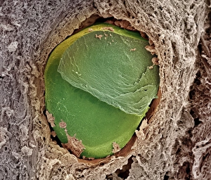 Coloured SEM Images Prints: Embolism