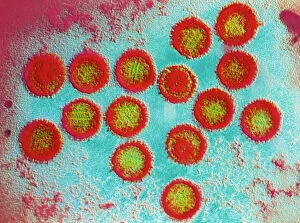 Images Dated 21st November 2003: Epstein-Barr virus particles
